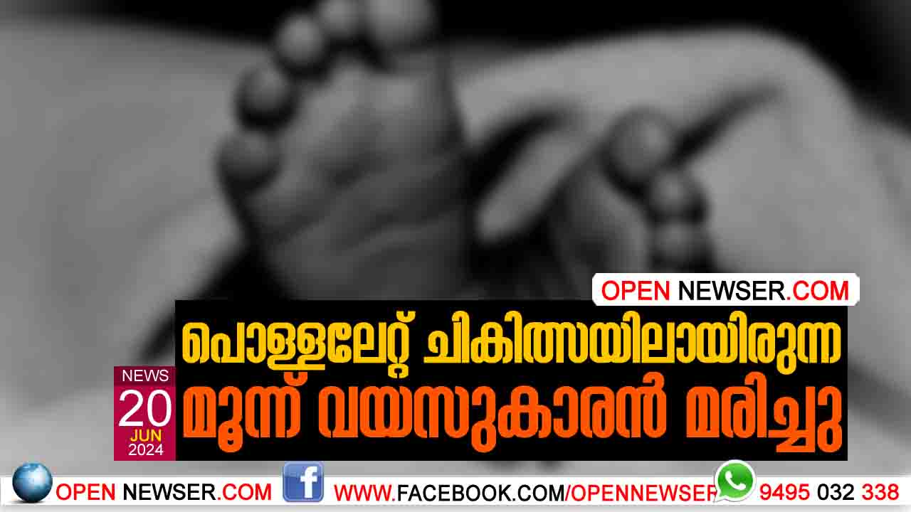 പൊള്ളലേറ്റ് ചികിത്സയിലായിരുന്ന മൂന്ന് വയസുകാരന് മരിച്ചു
