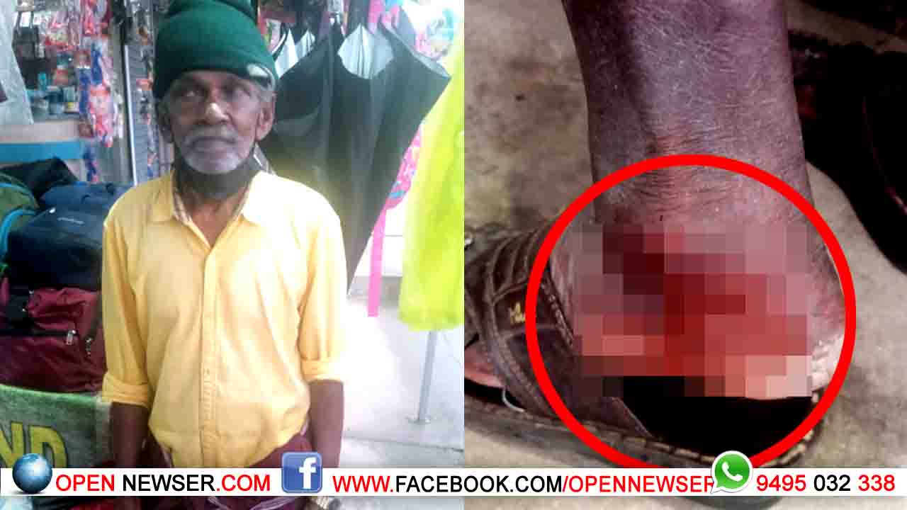 വീണ്ടും തെരുവ് നായയുടെ ആക്രമണം; വയോധികന് കടിയേറ്റു